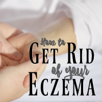 How to Treat Your Eczema